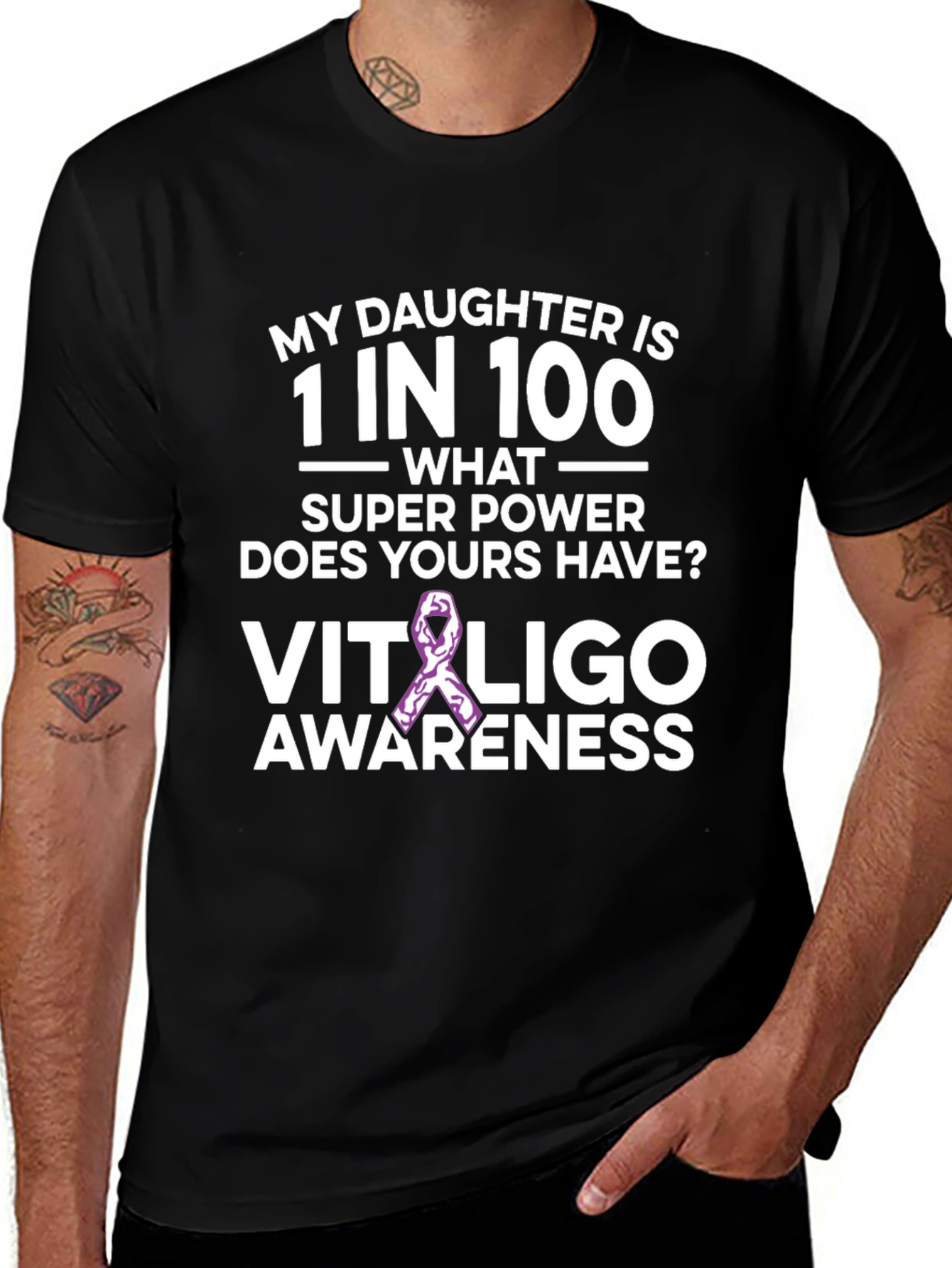 Camiseta Concientización Vitiligo - Hija Única