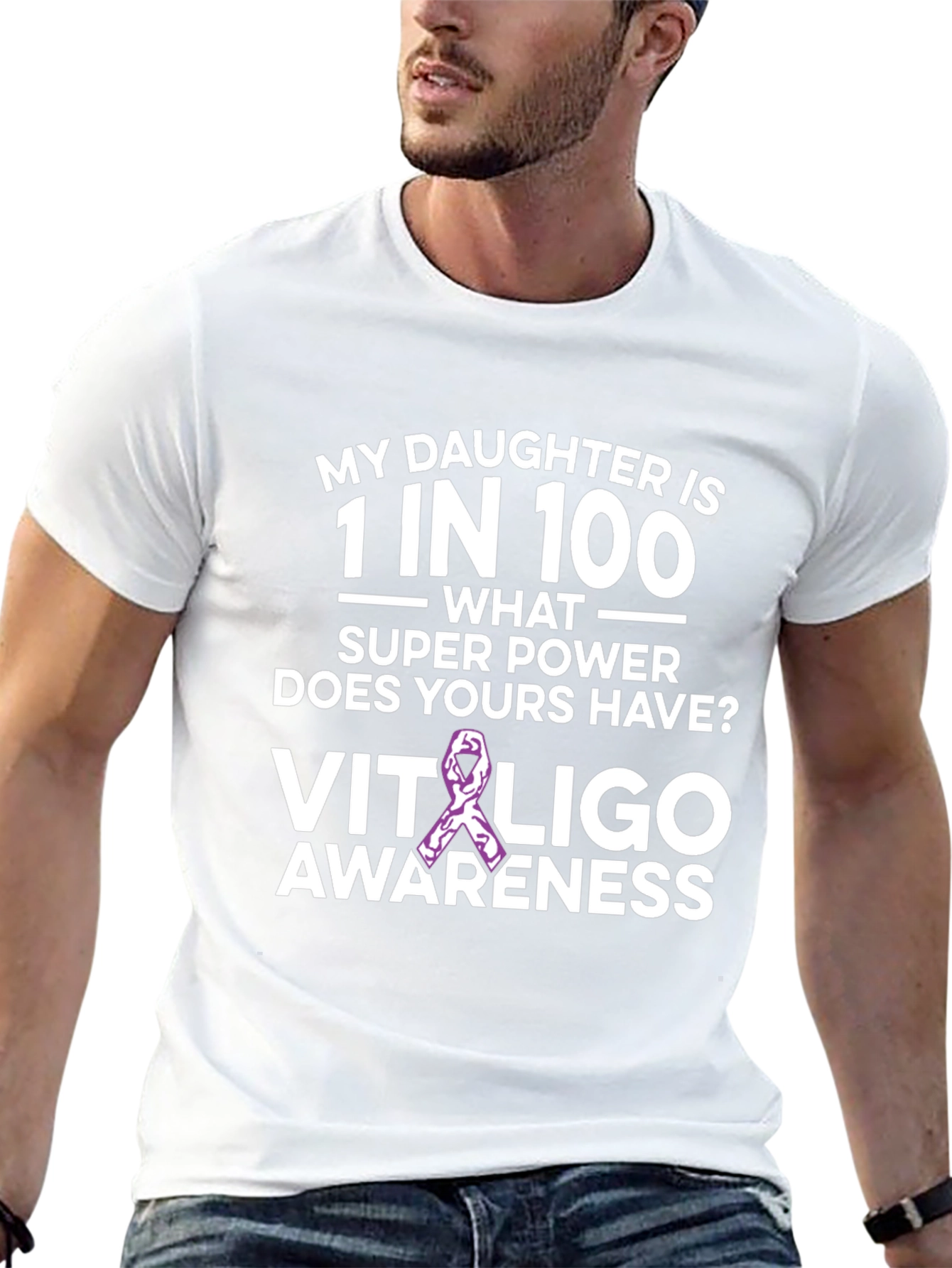 Camiseta Concientización Vitiligo - Hija Única
