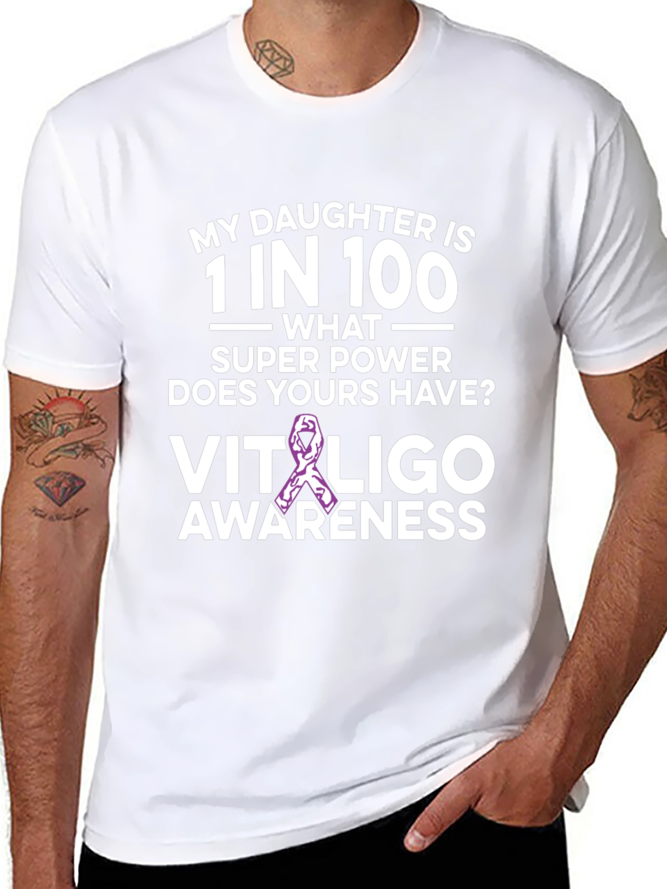 Camiseta Concientización Vitiligo - Hija Única