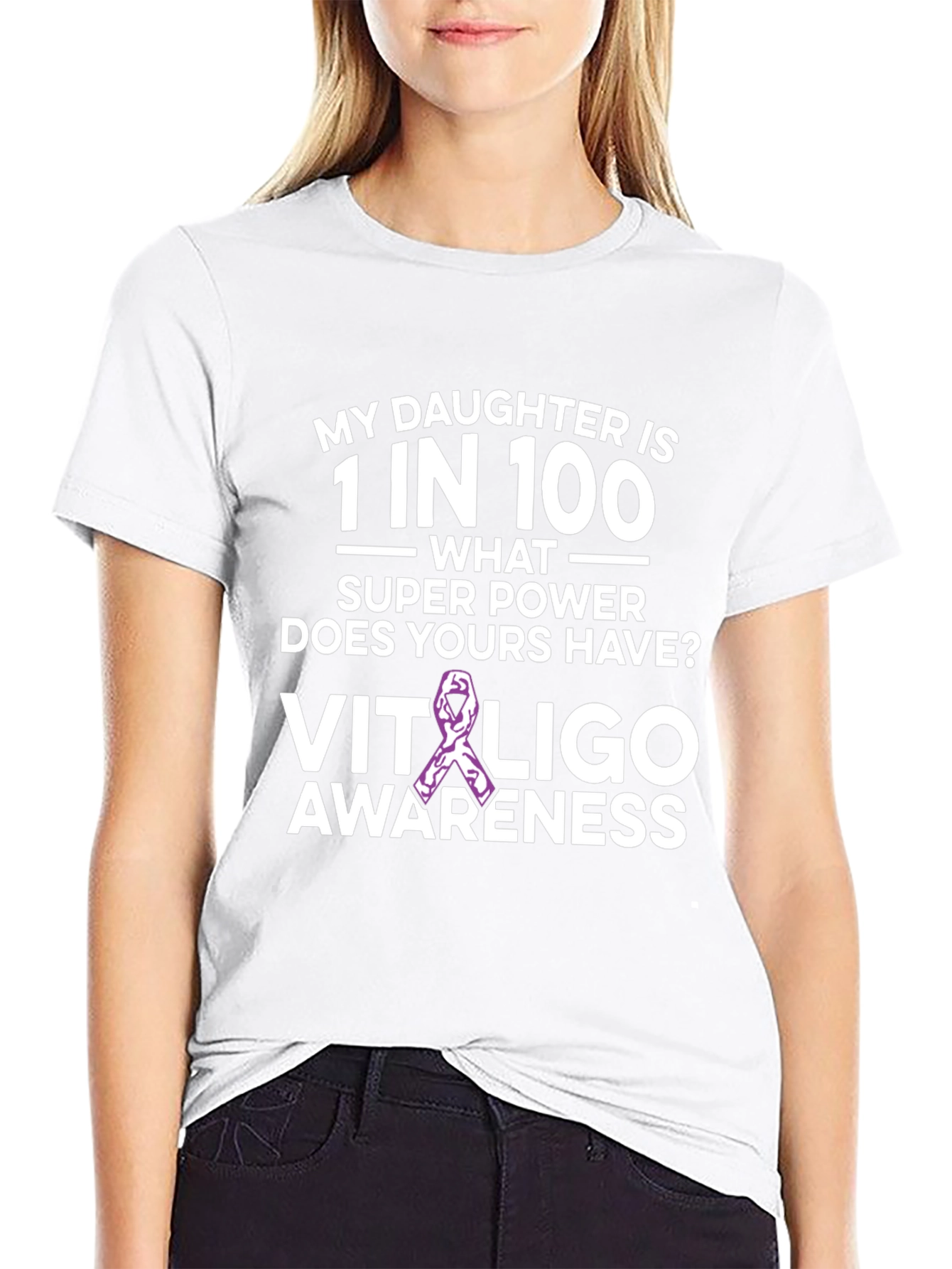 Camiseta Concientización Vitiligo - Hija Única