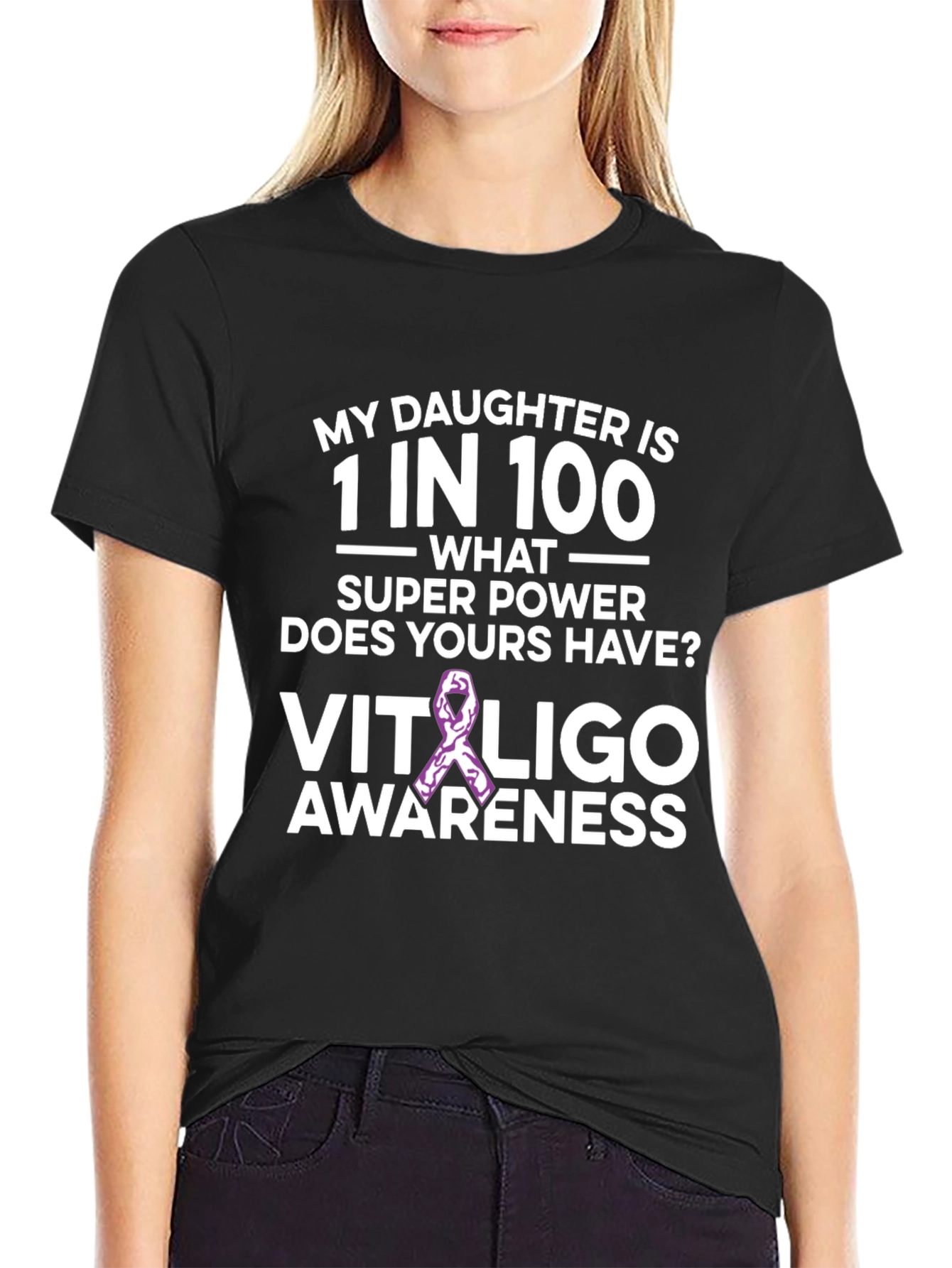 Camiseta Concientización Vitiligo - Hija Única